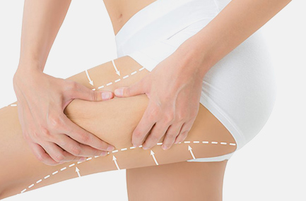 Lifting des cuisses Tunisie